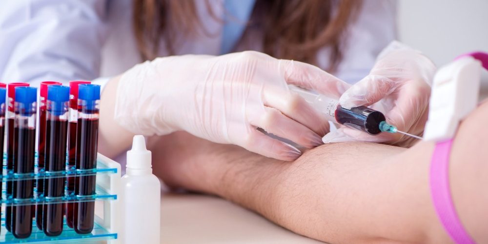 recoltari clinica hipomed