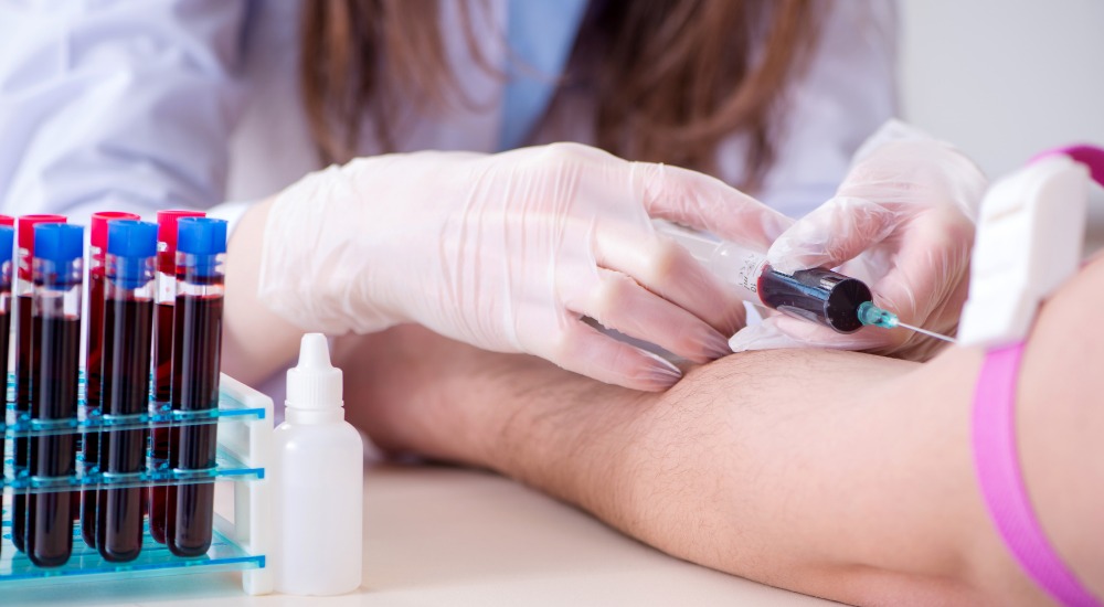 recoltari clinica hipomed